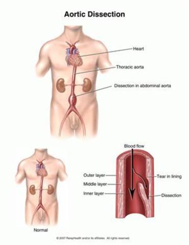 Disections of Humans