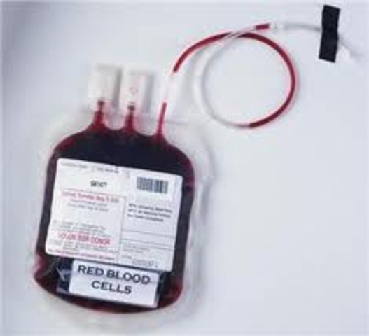 James Blundell performs the first successful transfusion of human blood