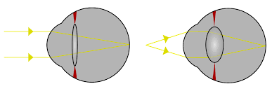 Explicació acomodació