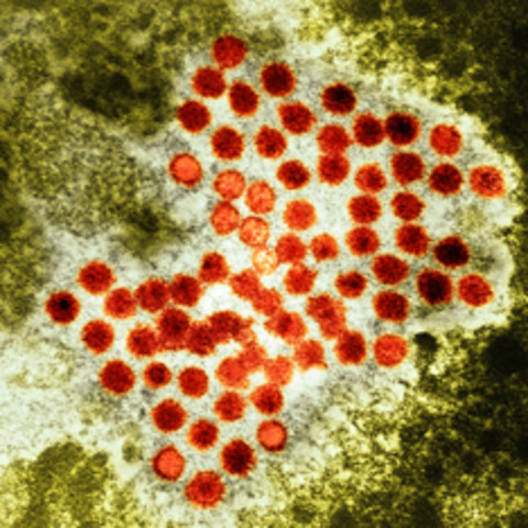 First vaccine developed for hepatitis A.