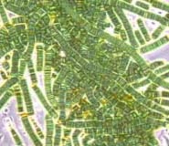 Anton van Leeuwenhoek observes bacteria.