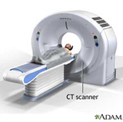 CAT- Scans