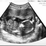 Se introducen máquinas de ultrasonido