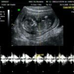 La ecografía se convierte en un procedimiento de rutina