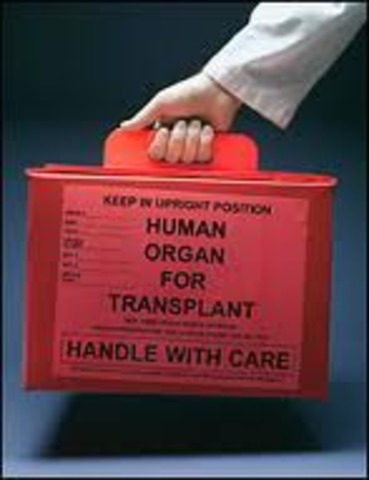 organ transplants