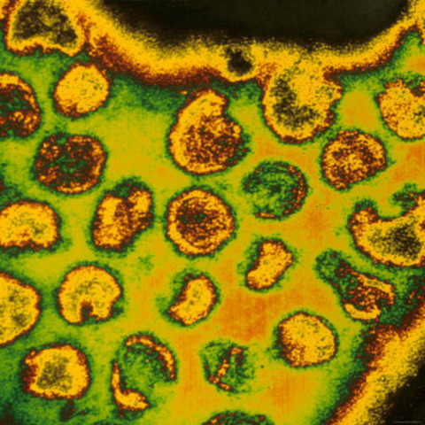 First vaccine developed for rubella