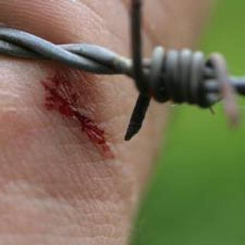 First vaccine for tetanus