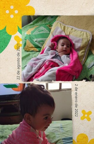 nacimiento sorpresivo