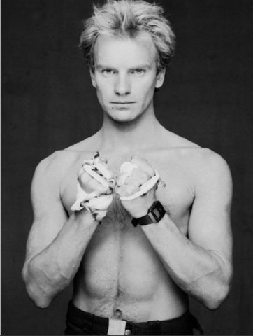 Sting