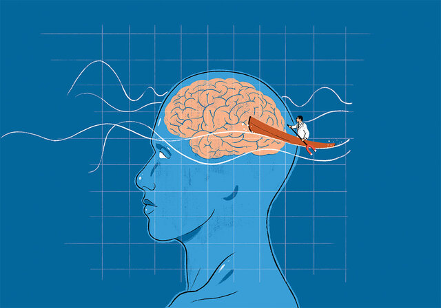 Estimulacion magnetica transcraneal
