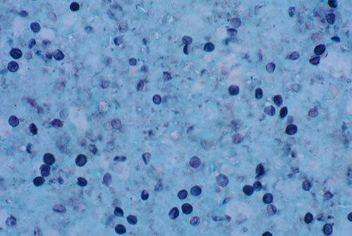 ORGANISMES QUIMIOHETERÒTROFS DE RESPIRACIÓ ANAERÒBICA