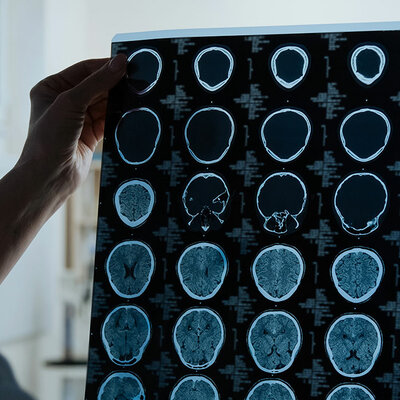 Timeline: Orígenes y evolución de la imagenología