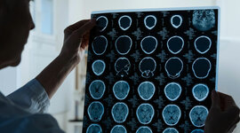 Timeline: Orígenes y evolución de la imagenología