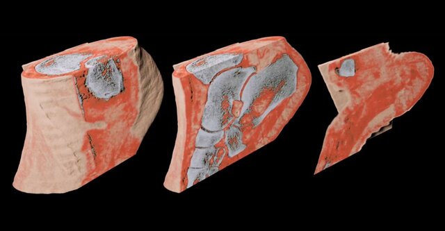 Primer escáner de rayos X en color humano