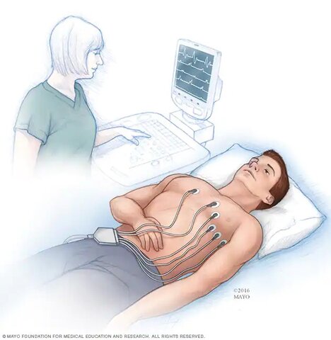 Invención del electrocardiograma