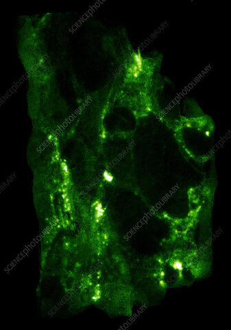 Uranio y emisión de rayos X