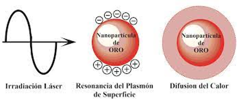 Hipertermia plasmónica