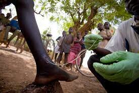 Guinea Worm Disease