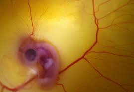 CASPAR FRIEDERICH WOLFF