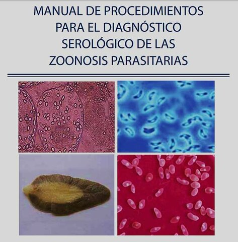 Normas Técnicas para el diagnostico serológico