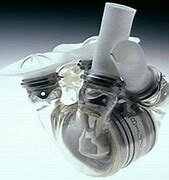 Primer corazón artificial