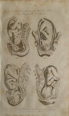 Licencia de Parteria en México