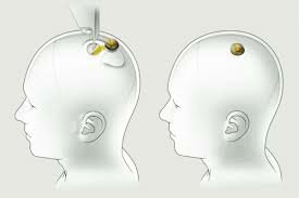 Controlar computadoras con el cerebro