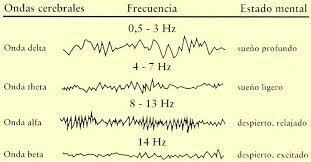 Electroencefalograma (EEG)