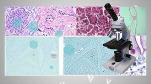 De transparencia o campo claro