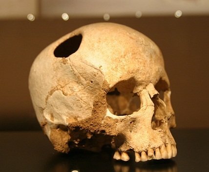 1. La enfermedad y la superstición.