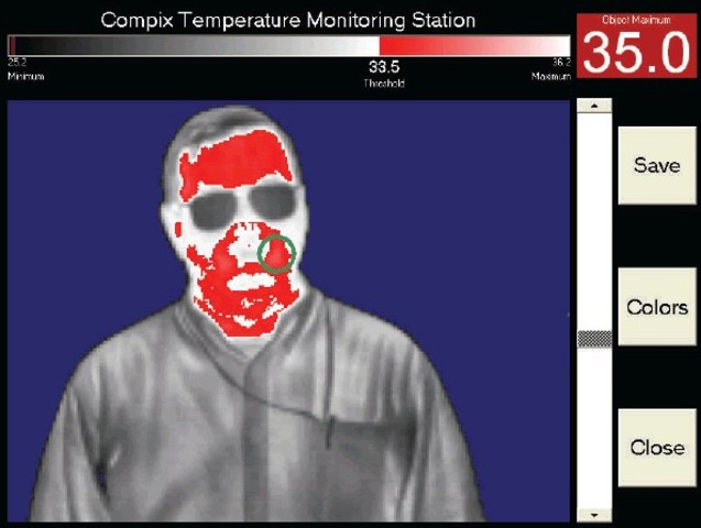 Infrared Fever Screening System