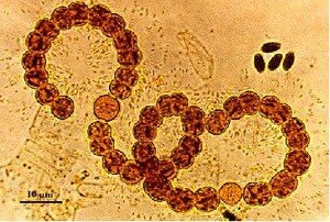 La teoría microbiana