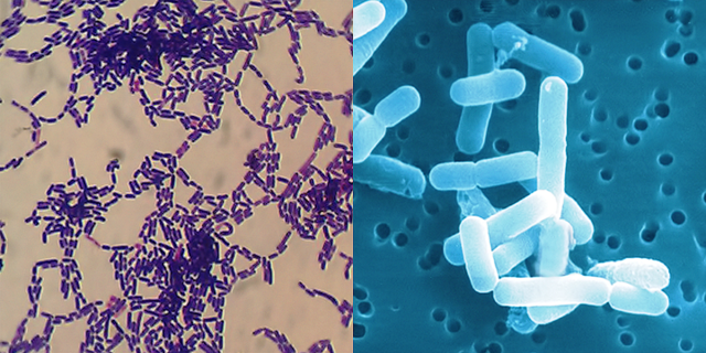 Aislamiento de microorganismos