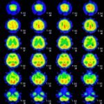 Resonancia magnética