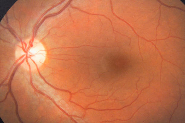 Descubrimiento de los nervios ópticos