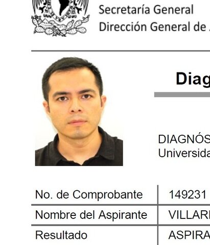 Tercera crisis depresiva