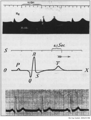 Invención del Electrocardiograma