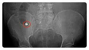 Procedimientos radiológicos