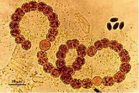 LA TEORÍA MICROBIANA SIN PASTEUR Y KOCH