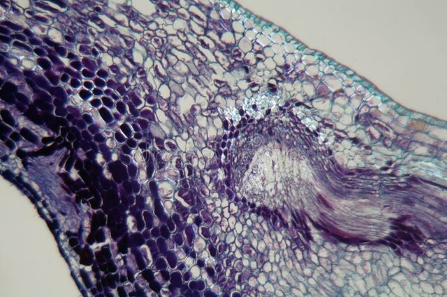 7. Teoría microbiana sin Pasteur y Koch