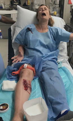 Trained as a trauma nurse