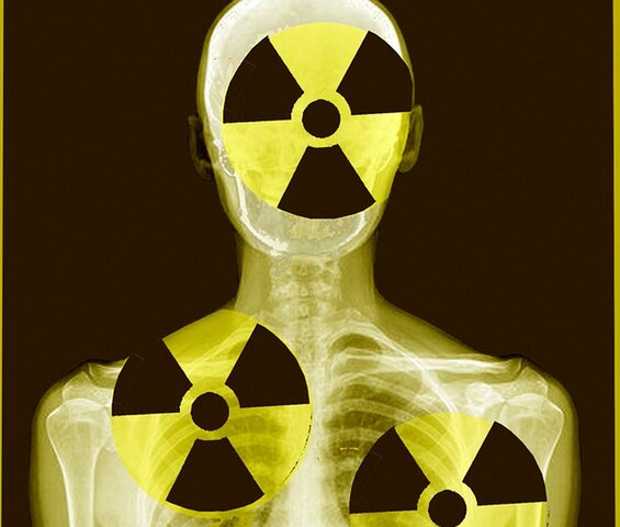 Primeras guías y recomendaciones en R-X.