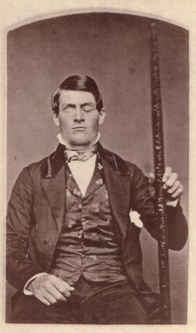 Phineas Gage - Accidente (Septiembre 1848)
