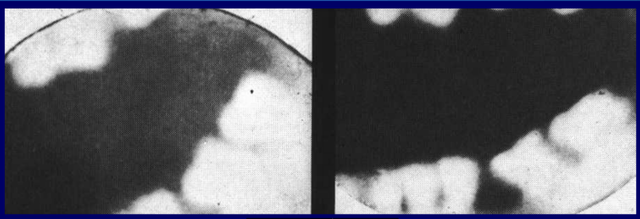 Primera radiografía dental del mundo