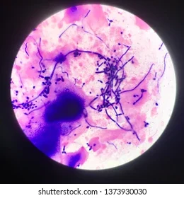 Bacillus Subtilis