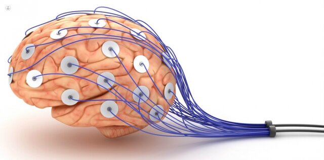 Neurofisiología (Finales del siglo XVIII)