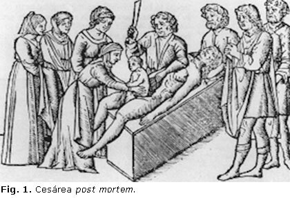Cesárea Post-Mortem