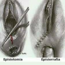 Dublin Fielding Ould