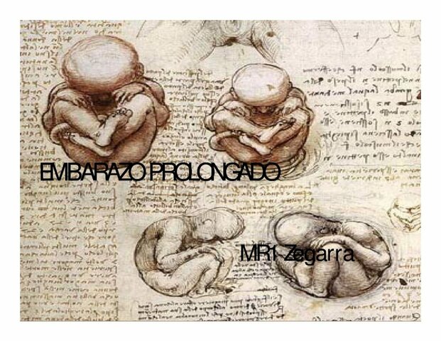 Embarazo prolongado