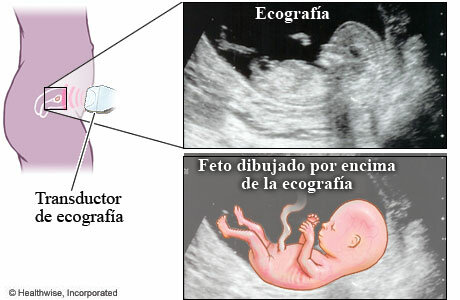 Monitorización electrónica fetal establecida hasta nuestros días